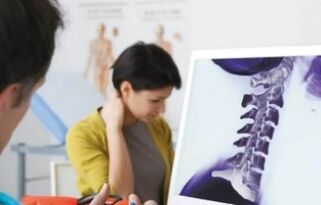 A méhnyak osteokondrózis kezelése