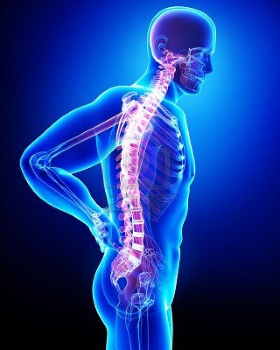 Az osteochondrosis által érintett emberi gerinc